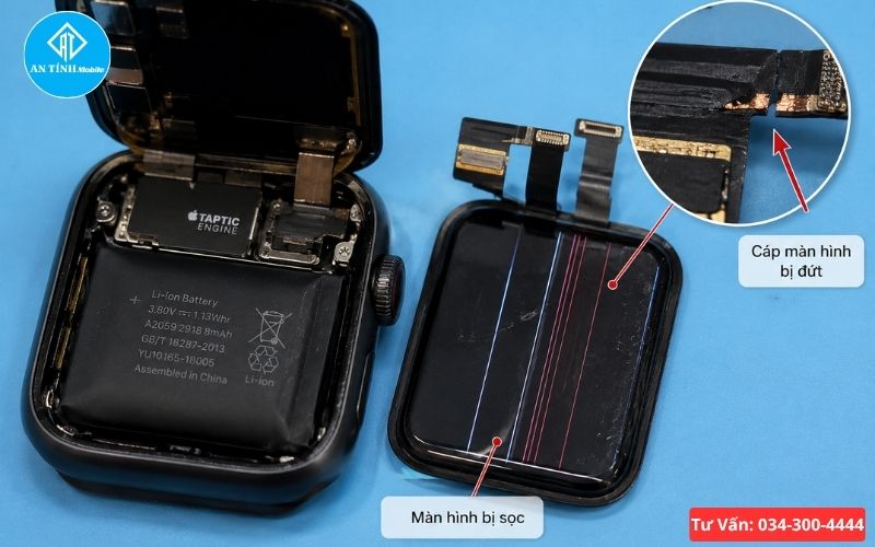 Rủi ro pin phù nếu không thay pin Apple Watch sớm